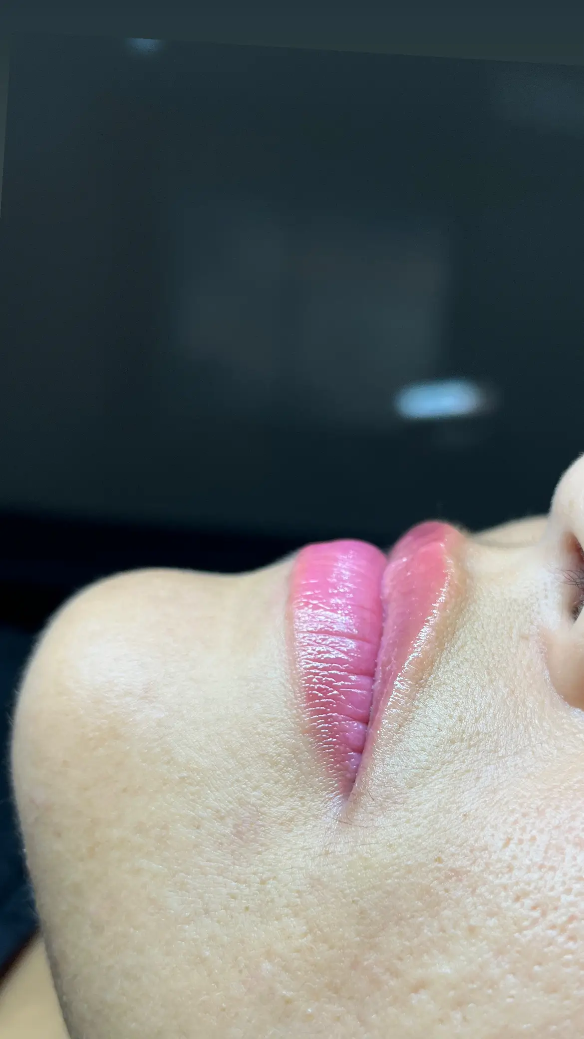 Lábios de cliente após hidratação labial no Sollere Studio